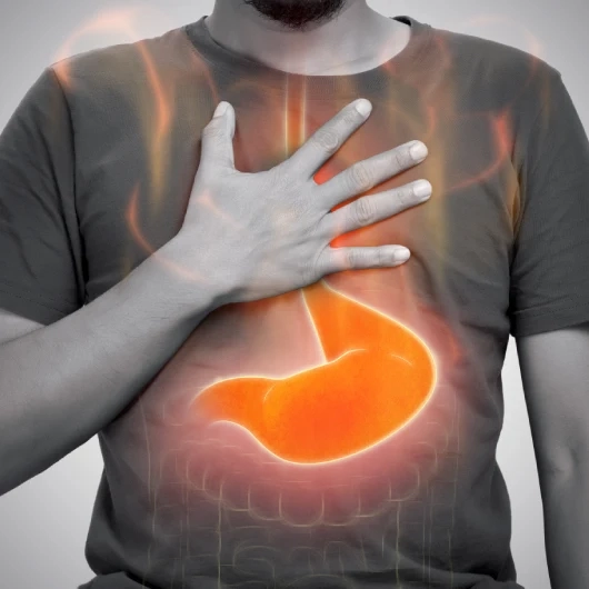 Gastroesophageal Reflux Disease Symptoms
