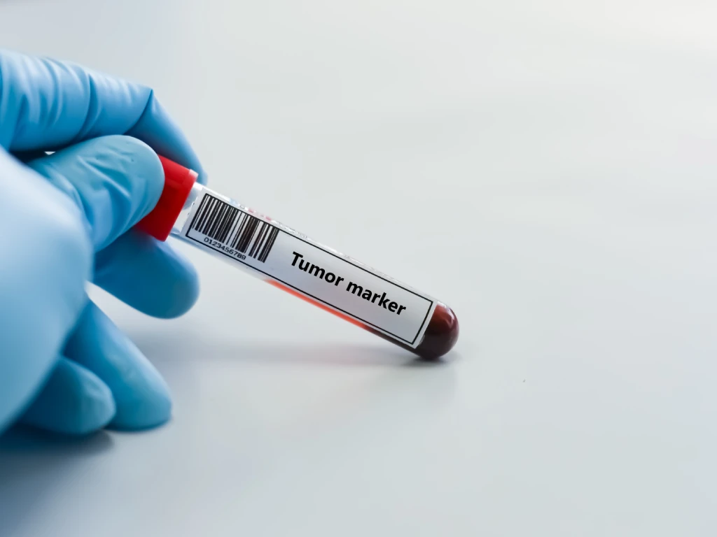 Tumour marker blood sample test