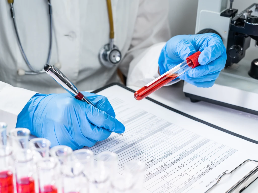 Tumour marker blood test in a laboratory
