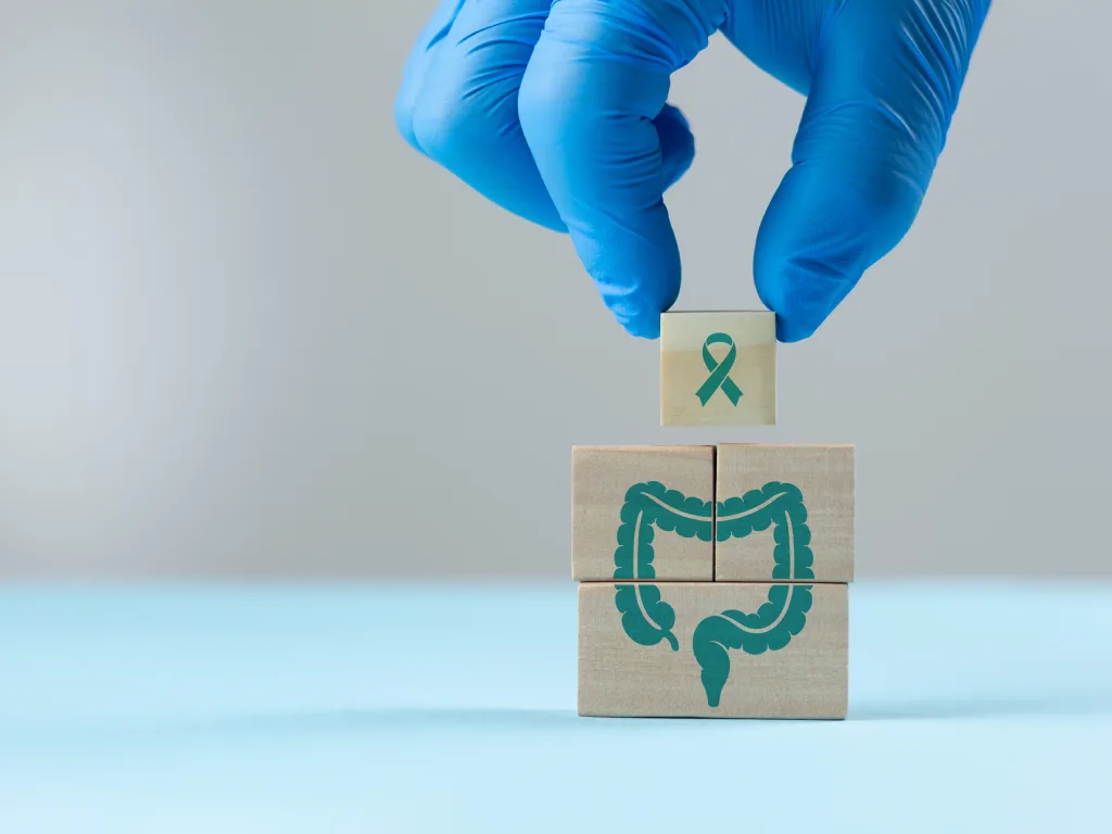 Colorectal Cancer Singapore