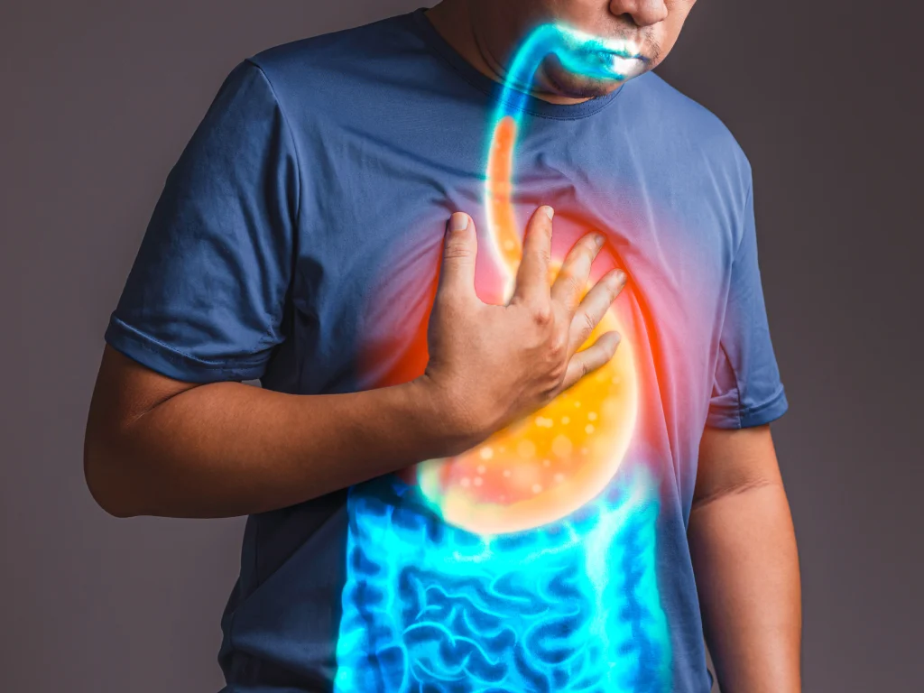 Gastroesophaegeal Reflux Disease