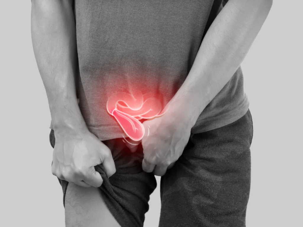 Inguinal Hernia Singapore