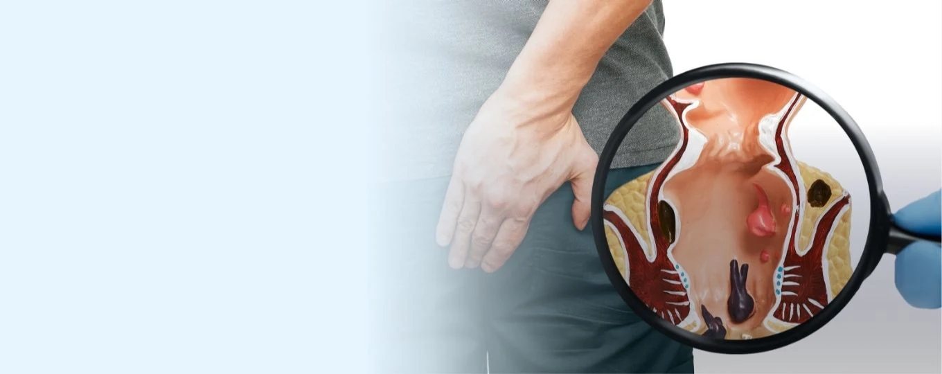 Dr Eugene Yeo, Piles and Haemorrhoids Treatment in Singapore