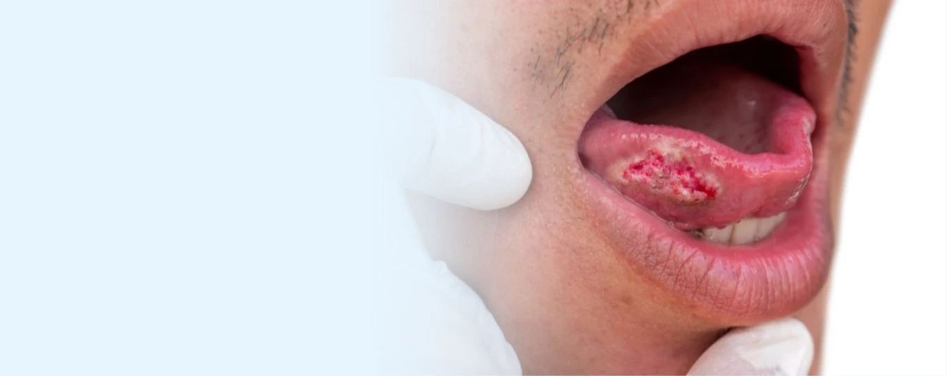 Dr Natascha Putri, Oral Cancer Specialist in Singapore