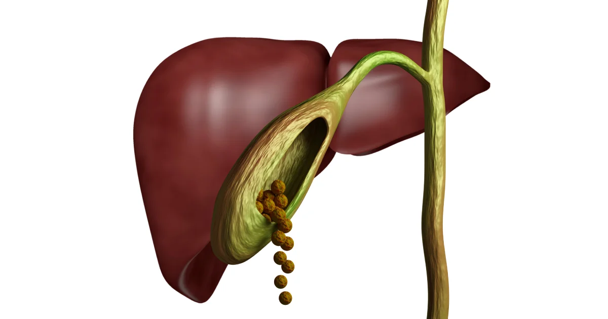 Gallbladder Surgery | Ten Surgery Singapore