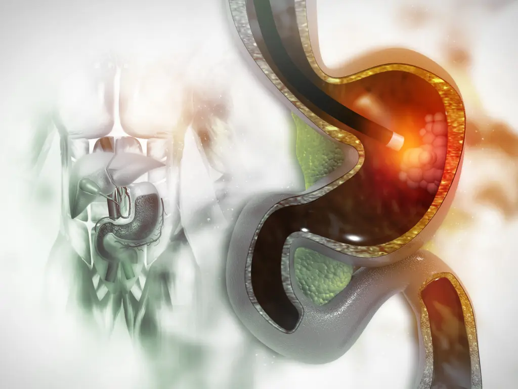 Gastroscopy Screening